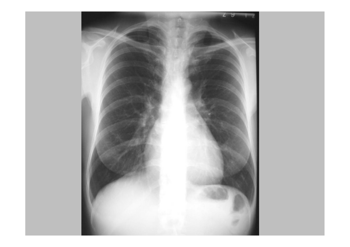 2e Bachelor: Cardiovasculair stelsel, ademhaling, nier en urinewegen (radio-anatomie)
