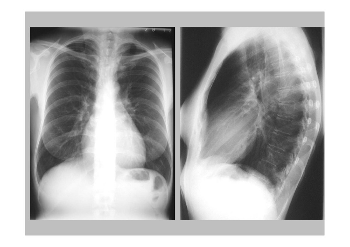 2e Bachelor: Cardiovasculair stelsel, ademhaling, nier en urinewegen (radio-anatomie)